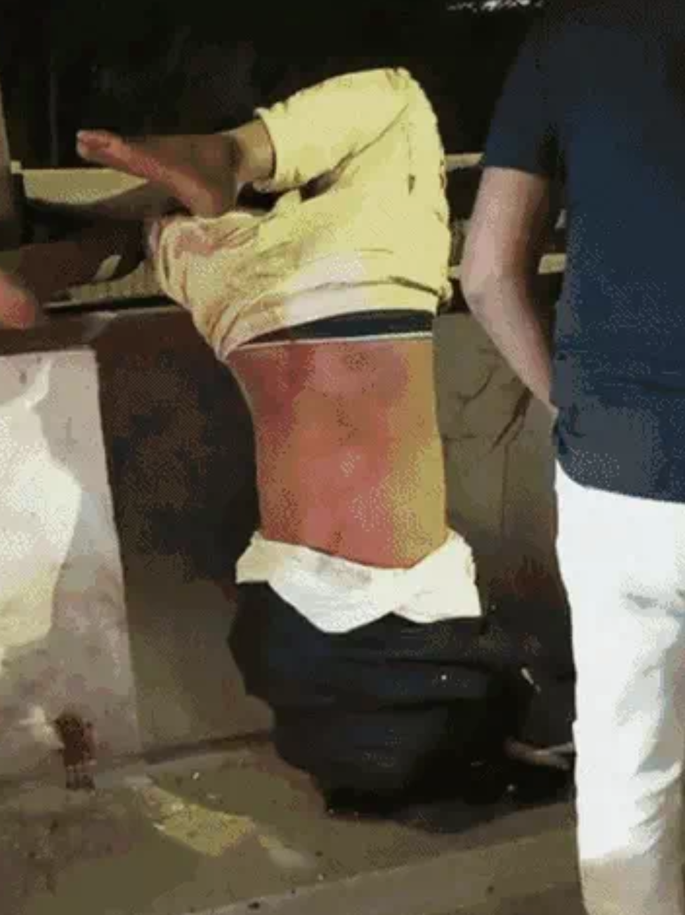 तेज रफ्तार का कहर: फॉर्च्यूनर की टक्कर से MBBS छात्र की मौत, 30 मिनट तक ओवरब्रिज की रेलिंग से लटकता रहा शव