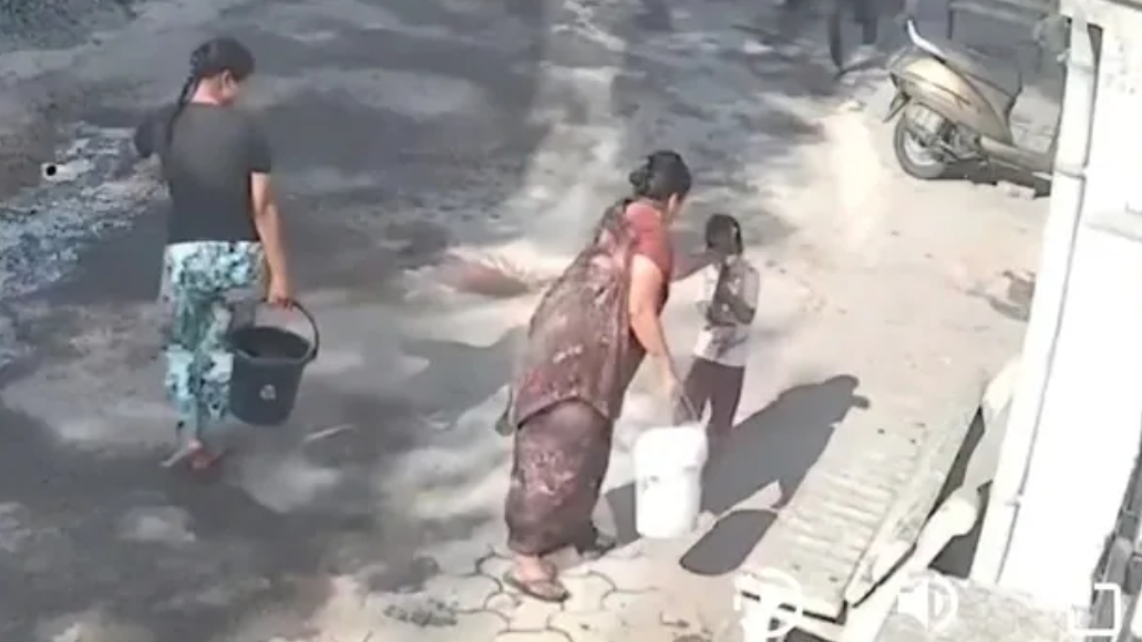 होली पर इंसानियत शर्मसार: दादी ने पोते पर उड़ेला खौलता पानी, 4 साल का मासूम 45% तक झुलसा
