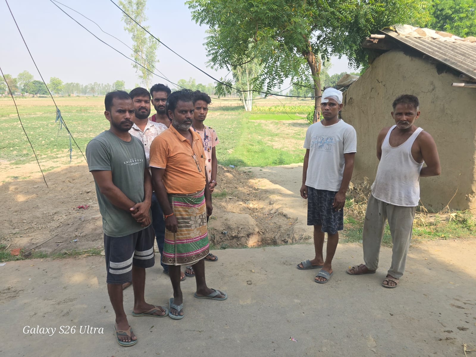 अंबेडकर नगर में जमीनी विवाद ने लिया हिंसक रूप, पीड़ित परिवार ने लगाए जानलेवा हमले और धमकी के आरोप
