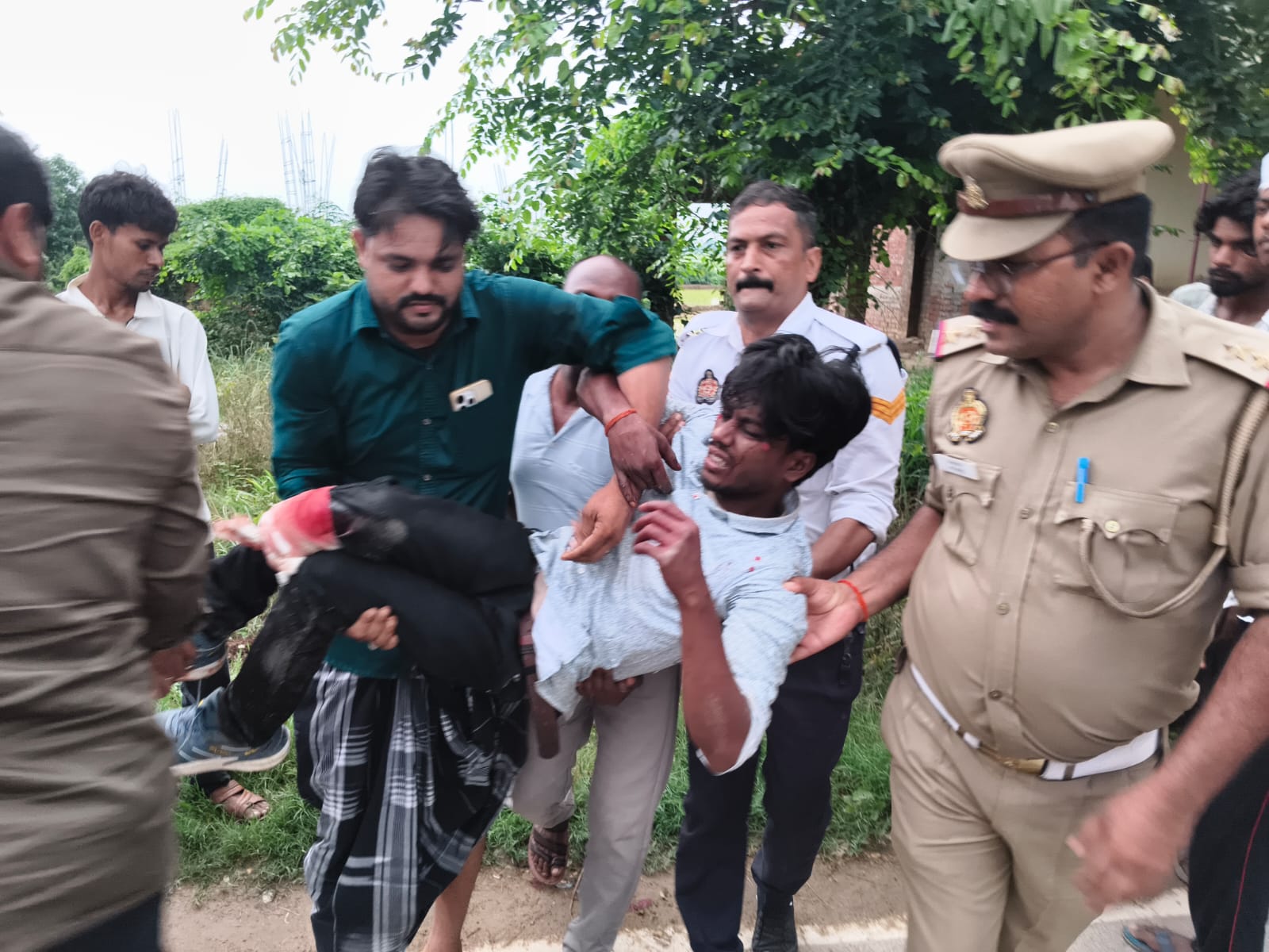 सड़क हादसे में घायल युवक के लिए देवदूत बनी अम्बेडकरनगर पुलिस, समय पर अस्पताल पहुंचाकर बचाई जान